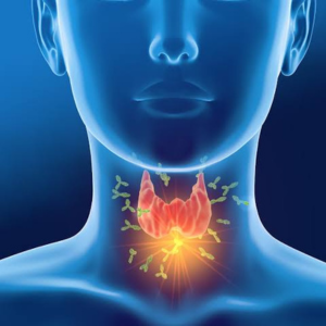 Thyroid Disorders